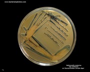 salmonella on deoxycholate citrate agar